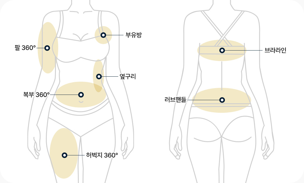 지방흡입 부위 팔 360도 부유방 옆구리 복부 360도 허벅지 360도 브라라인 러브핸들