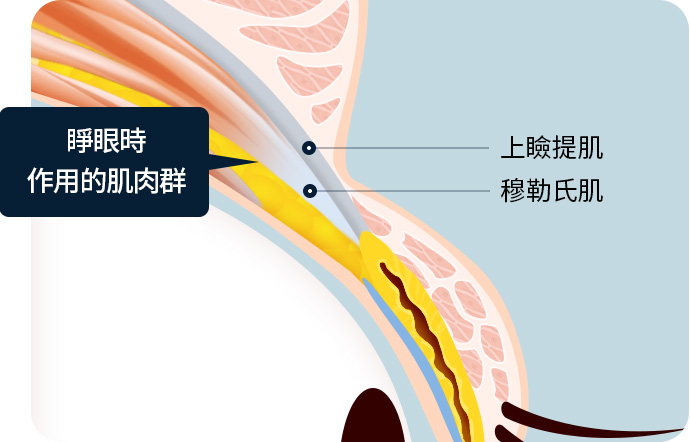 상안검거근 뮬러근