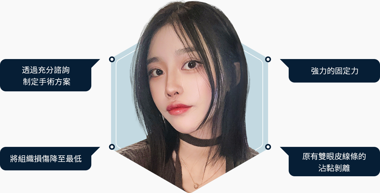 눈재수술 충분한 상담 수술플랜 강한 고정력 조직손상 최소화 기존 쌍꺼풀 유착박리