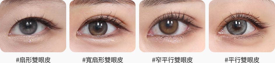 원더풀 라인낮추기 두줄따기 흉터제거 자연스러운 유착