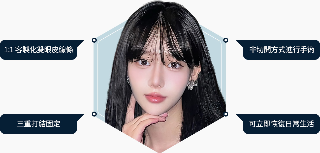 자연유착 맞춤라인 비절개 트리플매듭 일상생활 바로 가능