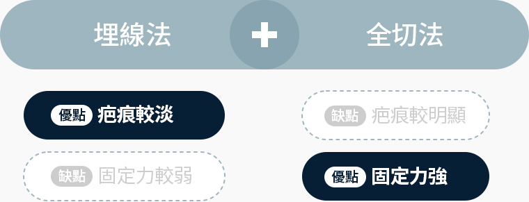 원더풀 라인낮추기 두줄따기 눈꺼풀 두께 눈뜨는 힘 지방량 피부 여유분