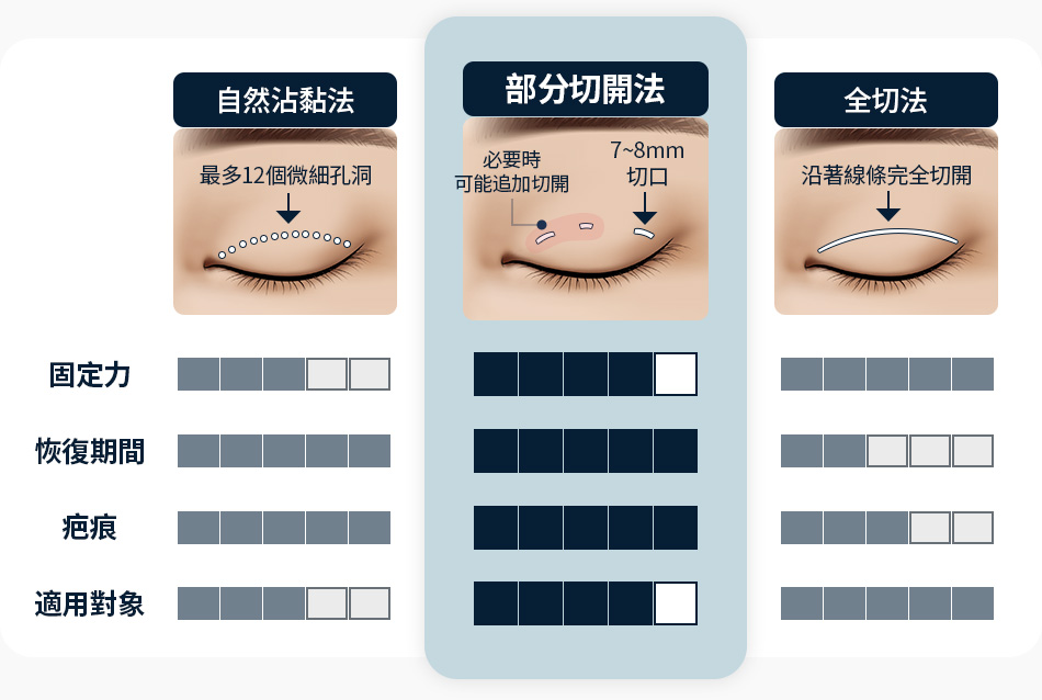 Wonderful 部分切開 자연유착 완전절개 빠른회복력 흉터최소화 강한고정력 적용 가능한 대상 다양함