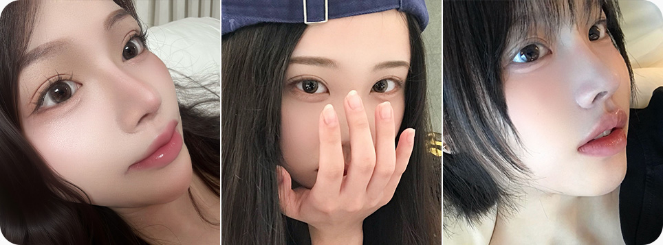 원더풀 라인낮추기 두줄따기 노하우 숙련된 의료진 고난이도 재수술 눈재수술