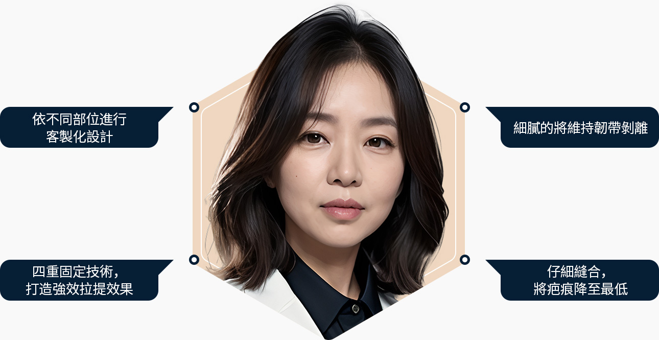 안면거상 고민부위별 맞춤디자인 유지인대 박리 4중고정 강력한 리프팅 꼼꼼한 봉합 흉터 최소화