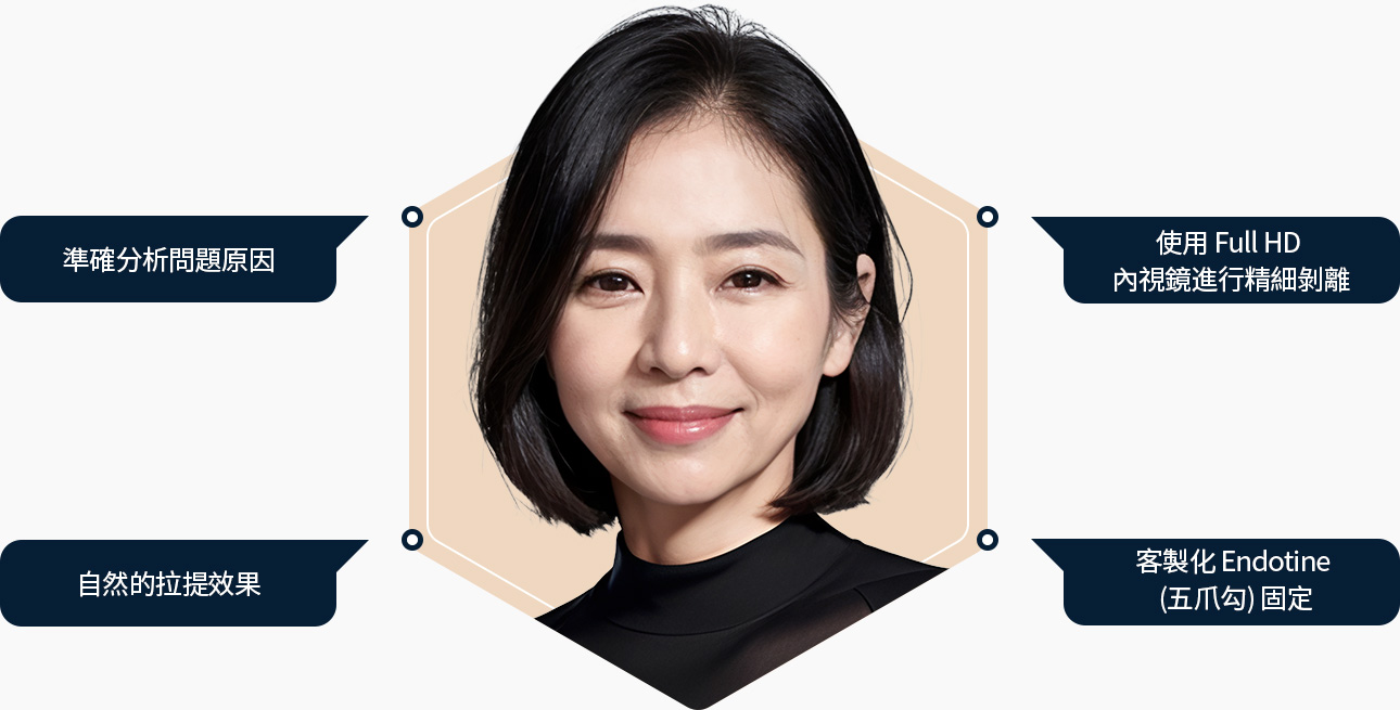 이마거상 정확한 원인분석 full HD 내시경으로 섬세한 박리 자연스러운 리프팅 효과 맞춤 엔도타인 고정