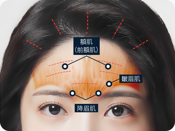 이마거상 전두근 추미근 눈썹내림근 섬세한 절개 및 박리 