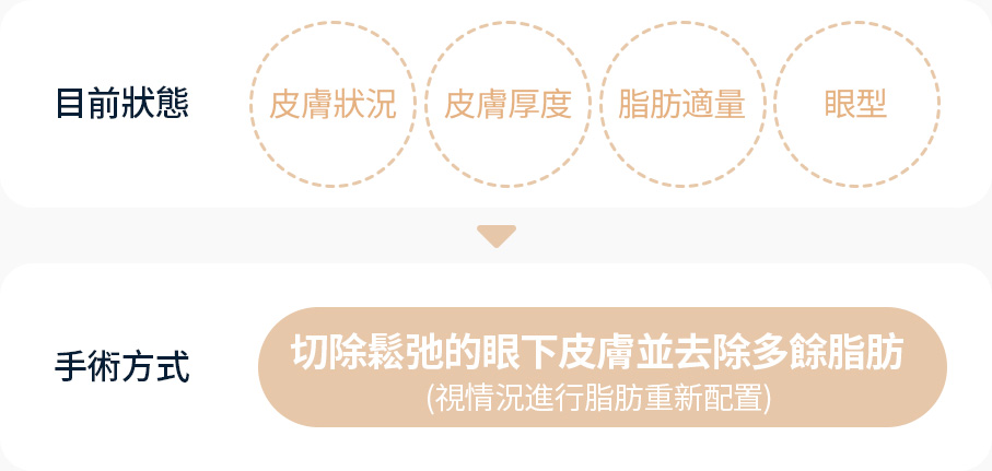 하안검 증상 피부상태 피부두께 지방적정량 눈모양 상태 확인 눈 밑 늘어진 피부절제 지방제거 필요시 지방재배치