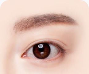 눈썹하거상술 방법 탄력있고 또력한 눈매완성