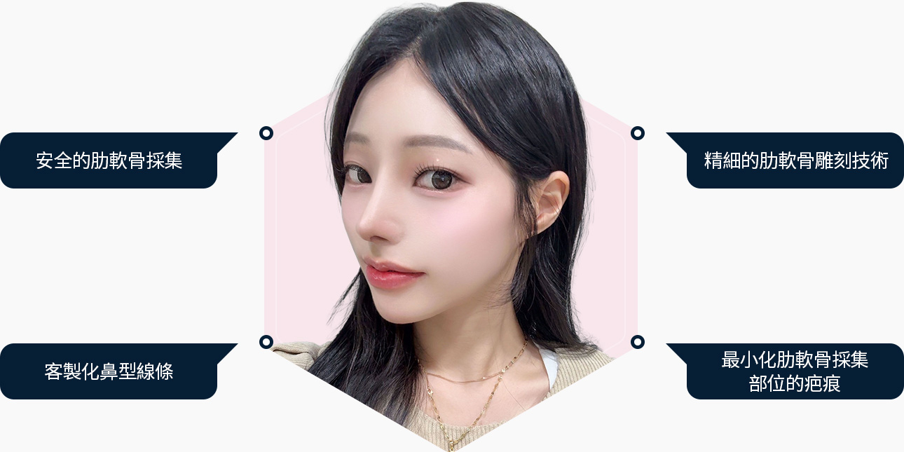 자가늑 코성형 안전한 늑연골 채취 섬새한 늑연골 조각 자려한 코라인 흉터최소화