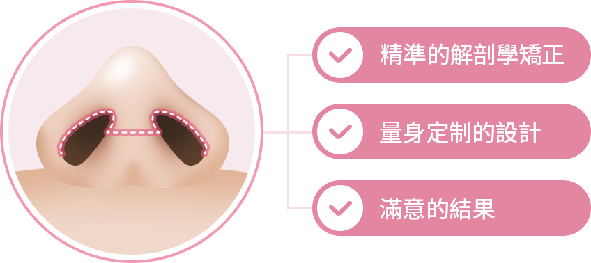 개방형 코수술 정확한 해부학적 교정 맞춤디자인 만족스러운 결과